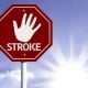 Gejala Tak Biasa dari Stroke yang Jarang Diketahui