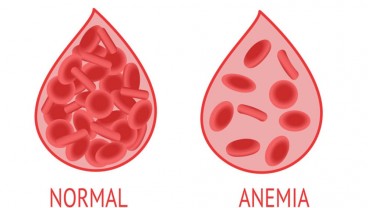 Awas! Anemia Bisa Hambat Tumbuh Kembang Anak