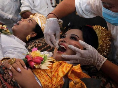 Sejumlah Remaja Penyandang Disabilitas di Bali Mengikuti Ritual Potong Gigi