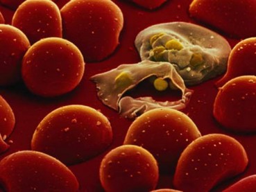 Sejarah Hari Malaria Sedunia, dan 10 Makanan Cegah Penyakit Mematikan Ini