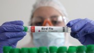 Satu dari Lima Sampel Susu Komersial di AS Mengandung Partikel Flu Burung