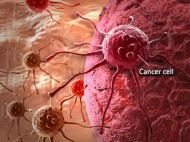 Peneliti Unair Temukan Senyawa Penghambat Sel Kanker, Raih Penghargaan Internasional