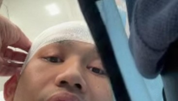 Indonesia vs Guinea Makan Korban, Kepala Witan Sulaeman Dapat 5 Jahitan