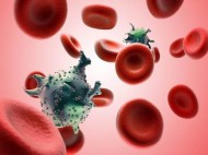 Ngeri, 30 Ribu Warga Inggris Tertular HIV Gara-gara Skandal Transfusi Darah
