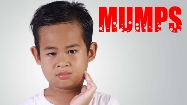 Awas, Kasus Gondongan Meningkat! Jangan Lupa Imunisasi MMR untuk Lindungi Anak