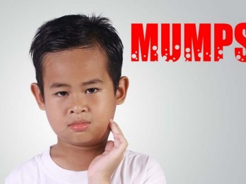 Awas, Kasus Gondongan Meningkat! Jangan Lupa Imunisasi MMR untuk Lindungi Anak