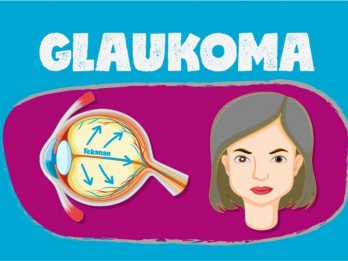 Fakta-fakta Glaukoma yang Bisa Sebabkan Kebutaan