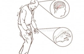 Tes Darah Teknologi AI Bisa Prediksi Gejala Penyakit Parkinson 7 tahun Sebelum Terjadi