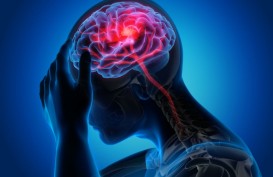 Jenis-jenis Migrain dan Cara Menyembuhkannya