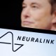 Elon Musk Pamer Cip Neuralink Berhasil Ditanamkan ke Otak Pasien Kedua