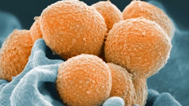 Superbugs Ancam Membunuh 39 Juta orang Hingga Tahun 2050