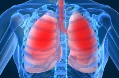 Mengenal Mycoplasma Pneumonia, Kasusnya Memuncak di Jepang