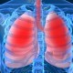 Mengenal Mycoplasma Pneumonia, Kasusnya Memuncak di Jepang