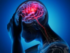 Ini Golongan Darah yang Paling Berisiko Kena Stroke