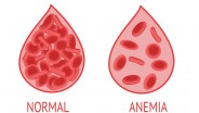 Ikatan Bidan Indonesia (IBI) Dorong Peran Bidan untuk Tekan Kasus Anemia pada Ibu Hamil