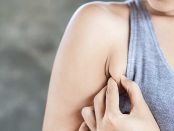 Cara Atasi Bau Badan yang Membandel