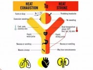 Seorang Perempuan Alami Heatstroke Setelah Sauna 45 Menit