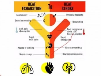 Seorang Perempuan Alami Heatstroke Setelah Sauna 45 Menit