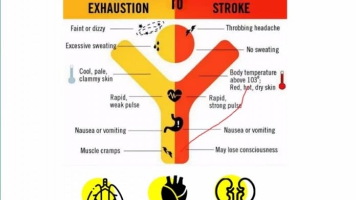 Seorang Perempuan Alami Heatstroke Setelah Sauna 45 Menit