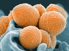 Mengenal Bakteri Clostridioides Difficile dan Cara Mengobatinya