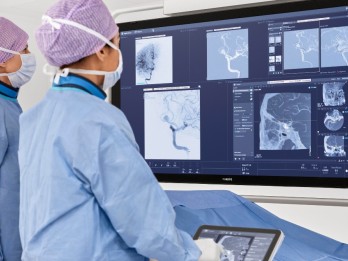 Philips, Bank Dunia, dan Kemenkes Ukraina Bantu Ribuan Pasien Stroke dengan AI