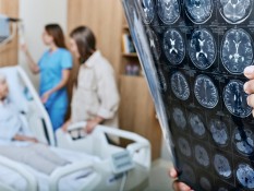 Ancaman Stroke Meningkat, Penanganan Terintegrasi Butuh Prioritas Global