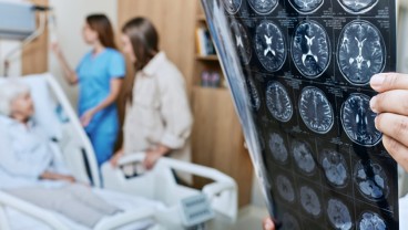 Ancaman Stroke Meningkat, Penanganan Terintegrasi Butuh Prioritas Global