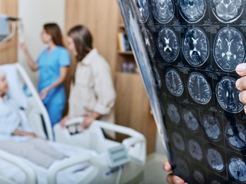 Ancaman Stroke Meningkat, Penanganan Terintegrasi Butuh Prioritas Global