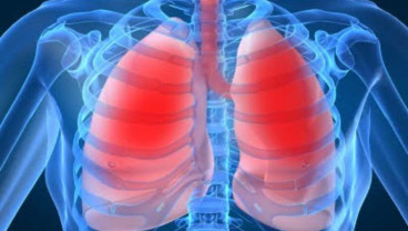 Flu Lama Sembuh, Waspada Mungkin Gejala Pneumonia