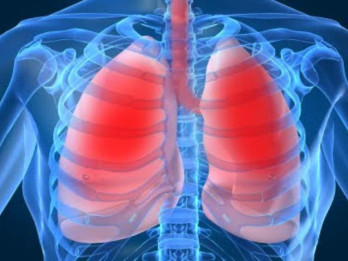 Flu Lama Sembuh, Waspada Mungkin Gejala Pneumonia