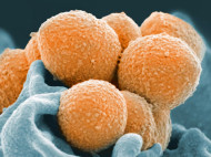 Bakteri Superbug Bisa Kebal Terhadap Antibiotik