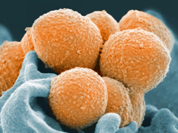 Bakteri Superbug Bisa Kebal Terhadap Antibiotik