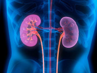 Transplantasi Ginjal Jadi Solusi Bagi Pasien Gagal Ginjal Kronis