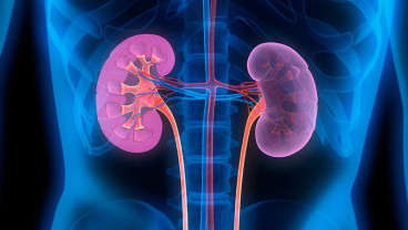 Transplantasi Ginjal Jadi Solusi Bagi Pasien Gagal Ginjal Kronis