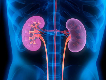 Transplantasi Ginjal Jadi Solusi Bagi Pasien Gagal Ginjal Kronis