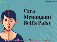 Mitos dan Fakta Seputar Bells Palsy yang Sering Disalahartikan