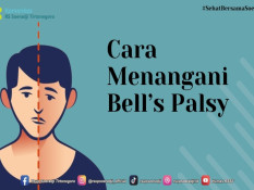 Mitos dan Fakta Seputar Bells Palsy yang Sering Disalahartikan