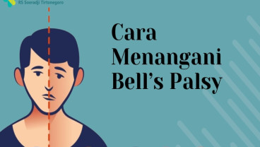 Mitos dan Fakta Seputar Bells Palsy yang Sering Disalahartikan