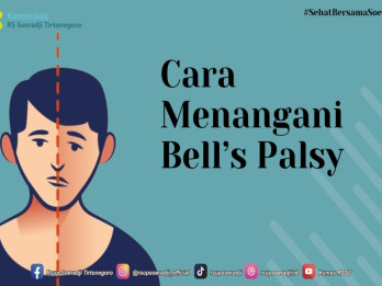 Mitos dan Fakta Seputar Bells Palsy yang Sering Disalahartikan