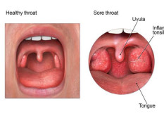 Mengenal Manfaat Gypsum Fibrosum dan Calcitum, Bisa Redakan Panas Dalam pada Anak