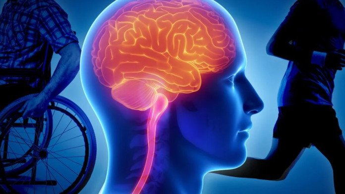Peran Ahli Neurologi dalam Penanganan Penyakit Saraf
