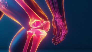 Nyeri Lutut Ganggu Aktivitas? Atasi dengan Knee Arthroplasty