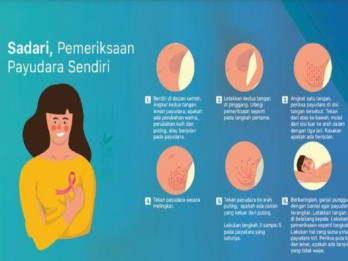 Terapi Presisi Tingkatkan Harapan Hidup Kanker Perempuan
