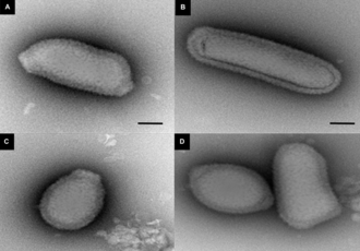 8 Virus dan Bakteri Zombie yang Bangkit Lagi Gara-gara Pemanasan Global