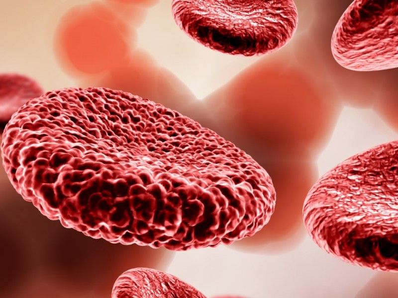 gejala dan cara mencegah anemia