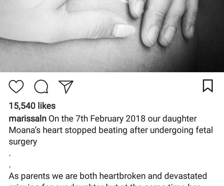 Salah Satu Anak Kembar Marissa Nasution Meninggal Saat Dilahirkan