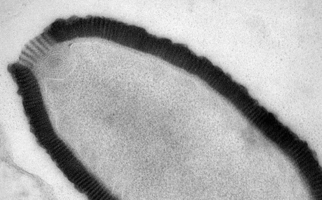 8 Virus dan Bakteri Zombie yang Bangkit Lagi Gara-gara Pemanasan Global